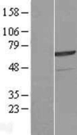 Novus Biologicals&trade;&nbsp;ZNF329 Overexpression Lysate