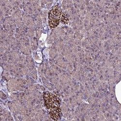 ZNF329 Antibody, Novus Biologicals 25 &mu;L, Unlabeled:Antibodies, Polyclonal