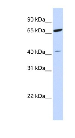 ZNF334 Antibody, Novus Biologicals 100&mu;L; Unlabeled:Antibodies, Polyclonal