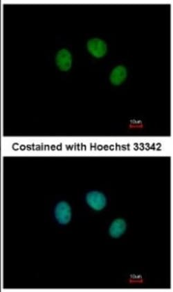 ZNF345 Antibody, Novus Biologicals 0.1mL; Unlabeled:Antibodies, Polyclonal