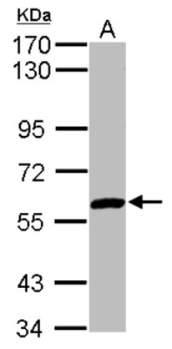 ZNF345 Antibody, Novus Biologicals 0.1mL; Unlabeled:Antibodies, Polyclonal
