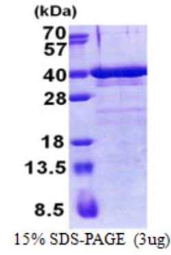 Novus Biologicals&trade;&nbsp;Recombinant Human ZNF346 His Protein