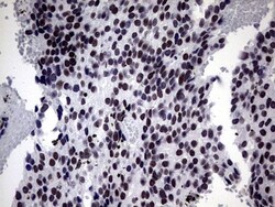 ZNF34 Antibody (OTI3G2), Novus Biologicals 0.1mL; Unlabeled:Antibodies,
