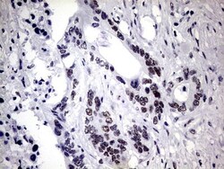 ZNF34 Antibody (OTI3G2), Novus Biologicals 0.1mL; Unlabeled:Antibodies,