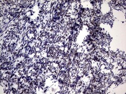 ZNF34 Antibody (OTI3G2), Novus Biologicals 0.1mL; Unlabeled:Antibodies,