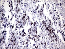 ZNF34 Antibody (OTI3G2), Novus Biologicals 0.1mL; Unlabeled:Antibodies,