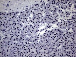 ZNF34 Antibody (OTI3G2), Novus Biologicals 0.1mL; Unlabeled:Antibodies,