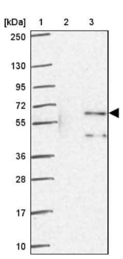 ZNF34 Antibody, Novus Biologicals 0.1mL; Unlabeled:Antibodies, Polyclonal