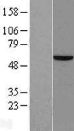 Novus Biologicals™ ZNF35 Overexpression Lysate