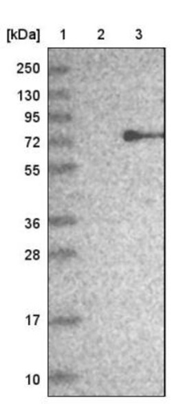 ZNF354B Antibody, Novus Biologicals 25 &mu;L | Buy Online | Novus Biologicals | Fisher Scientific