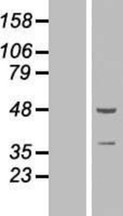 Novus Biologicals&trade;&nbsp;ZNF365 Overexpression Lysate