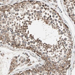 ZNF37A Antibody, Novus Biologicals:Antibodies:Primary Antibodies