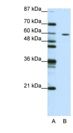 ZNF382 Antibody, Novus Biologicals 100&mu;L; Unlabeled:Antibodies, Polyclonal