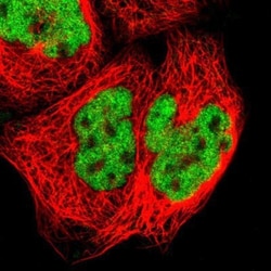 ZNF384 Antibody, Novus Biologicals:Antibodies:Primary Antibodies