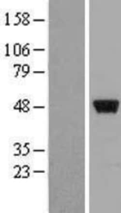 Novus Biologicals™ ZNF385 Overexpression Lysate