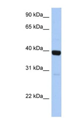 ZNF385B Antibody, Novus Biologicals 100&mu;L; Unlabeled:Antibodies, Polyclonal