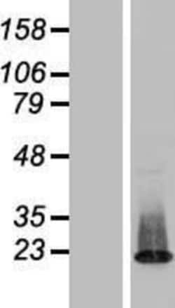 Novus Biologicals&trade;&nbsp;ZNF385C Overexpression Lysate