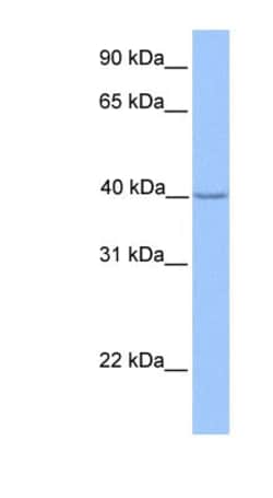 ZNF385D Antibody, Novus Biologicals:Antibodies:Primary Antibodies