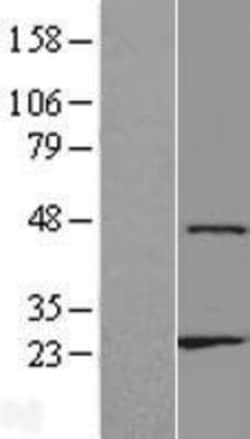 Novus Biologicals™ ZNF385D Overexpression Lysate
