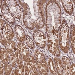 ZNF391 Antibody, Novus Biologicals 25 &mu;L, Unlabeled:Antibodies, Polyclonal
