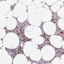 ZNF394 Antibody, Novus Biologicals 25 &mu;L, Unlabeled:Antibodies, Polyclonal
