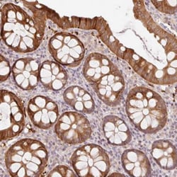 ZNF394 Antibody, Novus Biologicals 0.1mL; Unlabeled:Antibodies, Polyclonal