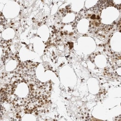 ZNF407 Antibody, Novus Biologicals:Antibodies:Primary Antibodies