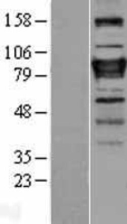 Novus Biologicals&trade;&nbsp;ZNF408 Overexpression Lysate