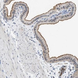 ZNF408 Antibody, Novus Biologicals:Antibodies:Primary Antibodies