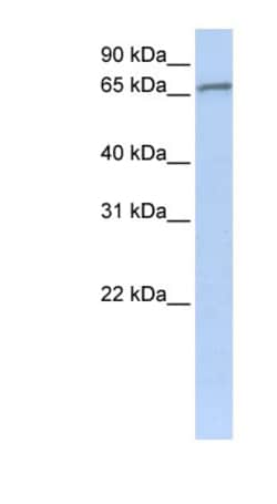 ZNF41 Antibody, Novus Biologicals 100&mu;L; Unlabeled:Antibodies, Polyclonal