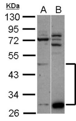 ZNF410 Antibody, Novus Biologicals 0.1mL; Unlabeled:Antibodies, Polyclonal