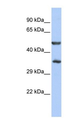 ZNF414 Antibody, Novus Biologicals 100&mu;L; Unlabeled:Antibodies, Polyclonal