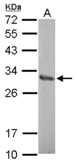 ZNF414 Antibody, Novus Biologicals 0.1mL; Unlabeled:Antibodies, Polyclonal