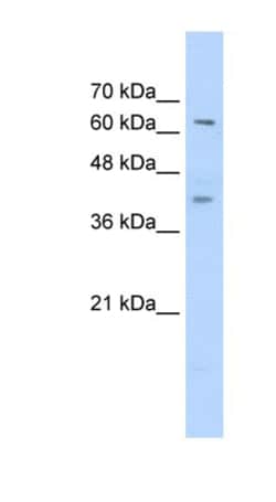 ZNF415 Antibody, Novus Biologicals 100&mu;L; Unlabeled:Antibodies, Polyclonal