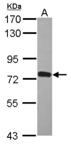 ZNF417 Antibody, Novus Biologicals 0.1mL; Unlabeled:Antibodies, Polyclonal