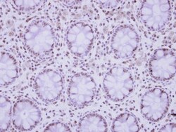 ZNF418 Antibody, Novus Biologicals 0.1mL; Unlabeled:Antibodies, Polyclonal