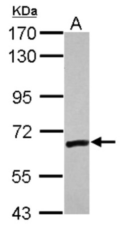 ZNF419A Antibody, Novus Biologicals 0.1mL; Unlabeled:Antibodies, Polyclonal