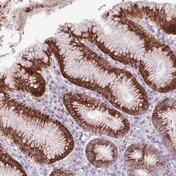 ZNF425 Antibody, Novus Biologicals 0.1mL; Unlabeled:Antibodies, Polyclonal