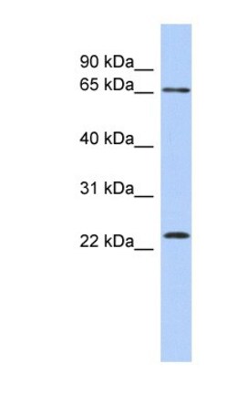 ZNF428 Antibody, Novus Biologicals 100&mu;L; Unlabeled:Antibodies, Polyclonal