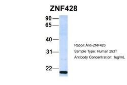 ZNF428 Antibody, Novus Biologicals 100&mu;L; Unlabeled:Antibodies, Polyclonal