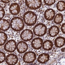 ZNF428 Antibody, Novus Biologicals 25 &mu;L | Buy Online | Novus Biologicals | Fisher Scientific