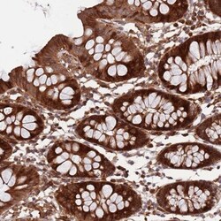 ZNF428 Antibody, Novus Biologicals:Antibodies:Primary Antibodies