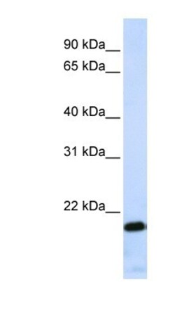 ZNF428 Antibody, Novus Biologicals 100&mu;L; Unlabeled:Antibodies, Polyclonal