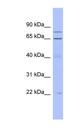 ZNF431 Antibody, Novus Biologicals 100&mu;L; Unlabeled:Antibodies, Polyclonal
