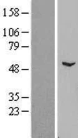 Novus Biologicals&trade;&nbsp;ZNF436 Overexpression Lysate