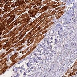 ZNF436 Antibody, Novus Biologicals 0.1mL; Unlabeled:Antibodies, Polyclonal