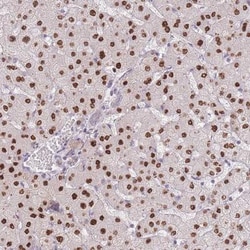 ZNF439 Antibody, Novus Biologicals:Antibodies:Primary Antibodies
