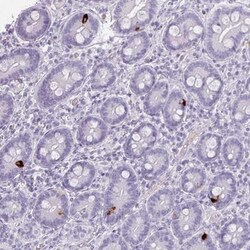 ZNF43 Antibody, Novus Biologicals 25 &mu;L, Unlabeled:Antibodies, Polyclonal