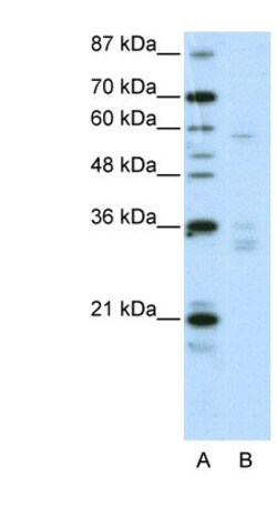 ZNF440 Antibody, Novus Biologicals 100&mu;L; Unlabeled:Antibodies, Polyclonal