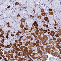 ZNF442 Antibody, Novus Biologicals 25 &mu;L, Unlabeled:Antibodies, Polyclonal